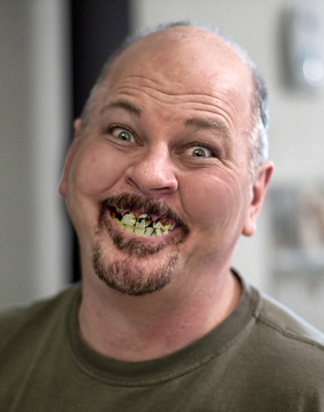 Meth Mouth