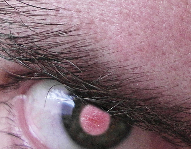 ziteye
