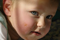 Chocolate Cheeks