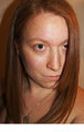 new hair-style- straightened hair (worn over my injured eye)