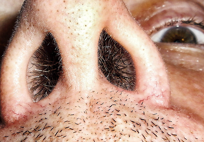 Do I have a booger