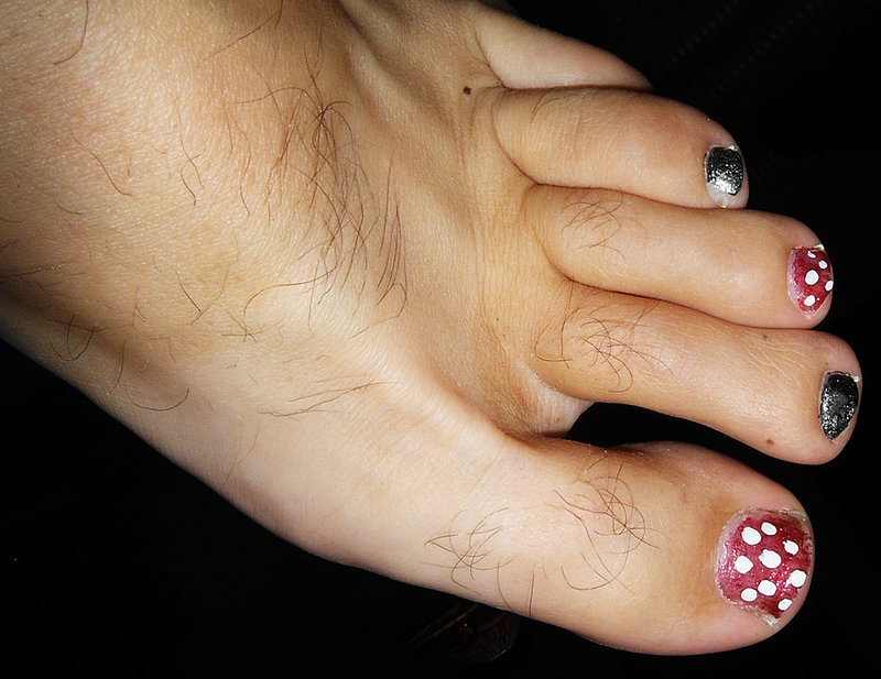 toenails