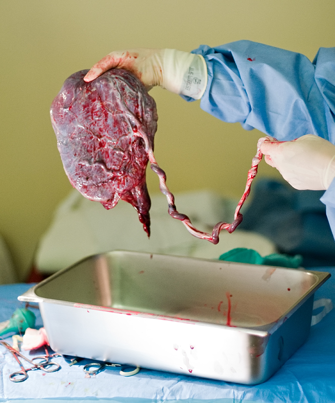 DSC_6322-placenta.jpg