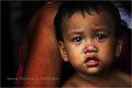 Child's Eye