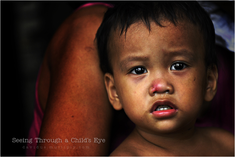 Child's Eye