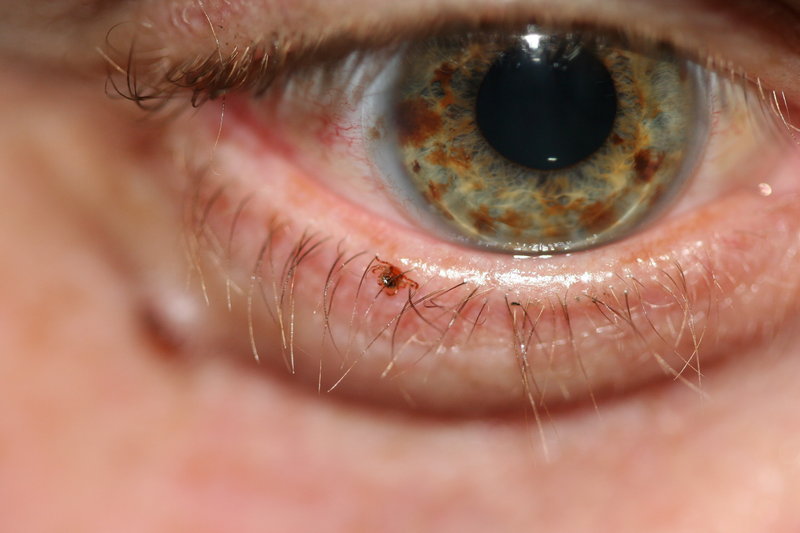 Eye to Eye