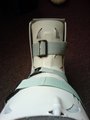 My Leg