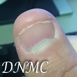 thumbnail-dnmc