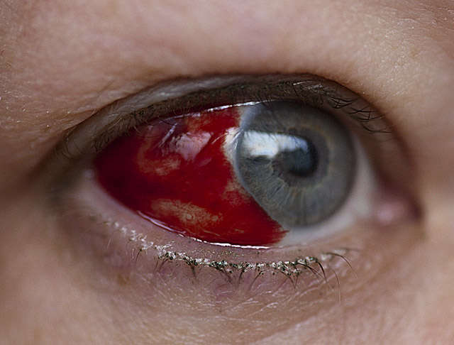 Halloween eye