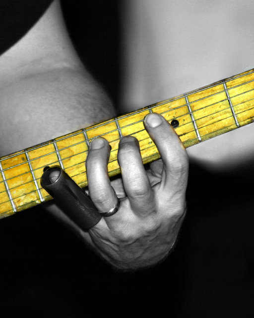 Frets