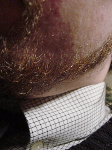 Portrait (Extreme Close-Up)