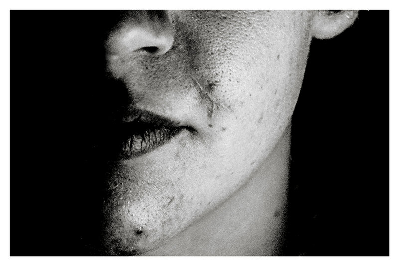 Imperfection