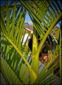 Treeview