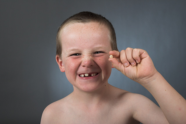 lachielosttooth.jpg