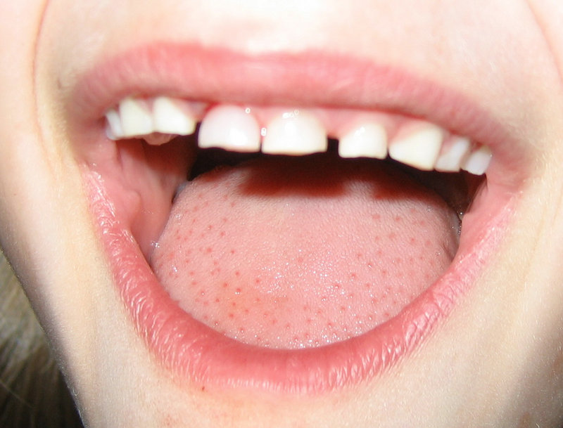 Mystery Picture 5 ANSWER