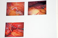 Surgery