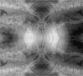 XRay #2