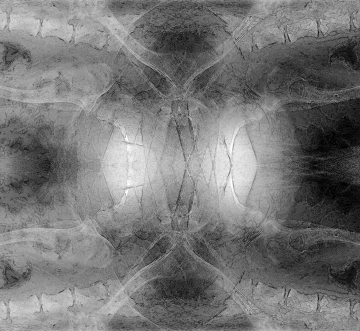 XRay #2