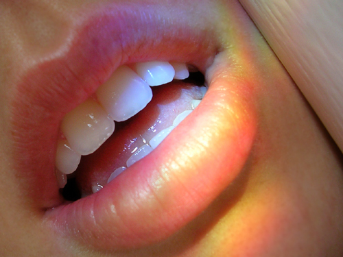 Rainbow Lips