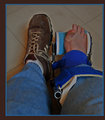 Day-26-Dynasplint.jpg