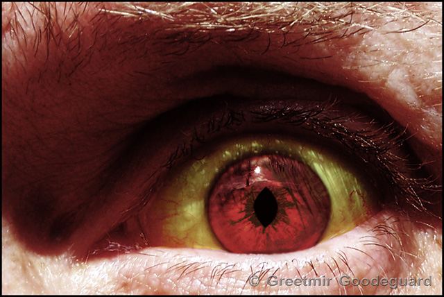 Evil Eye