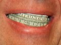day 16 - Flashing a $1.000000 Smile