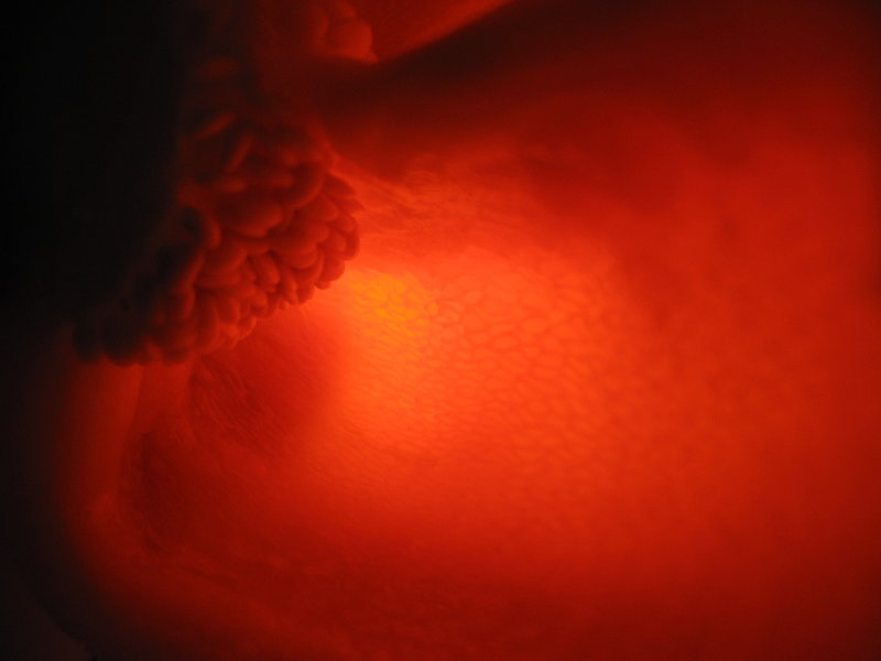 Cardiology