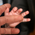 Hands