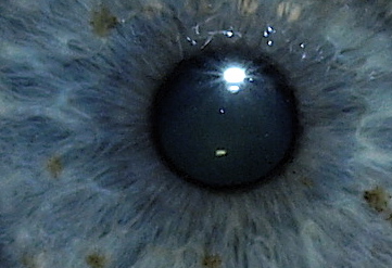 Eyeris and the pupil