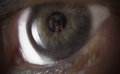 My Eye Reflect 