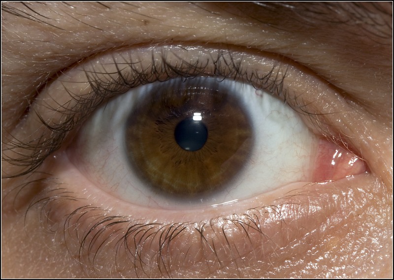 #13 - Eye for an Eye